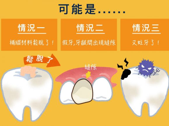 蒔美牙齒保健常識補完牙為什麼會牙齒痠痛呢-4-580x435