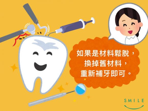 蒔美牙齒保健常識補完牙為什麼會牙齒痠痛呢-5-580x435