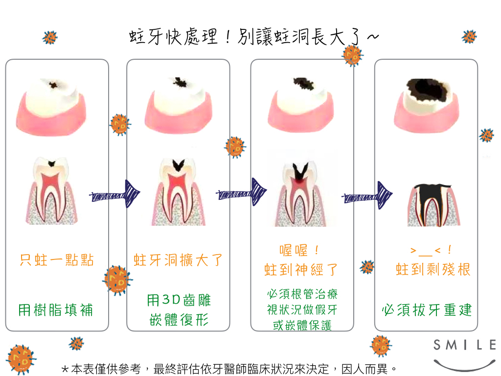 蒔美醫師專欄根管治療後一定得裝牙套嗎-2