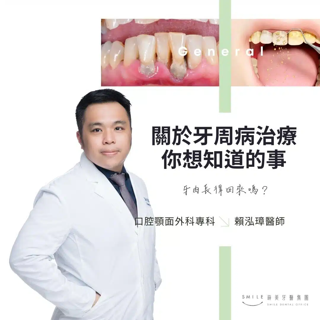 關於牙周病治療