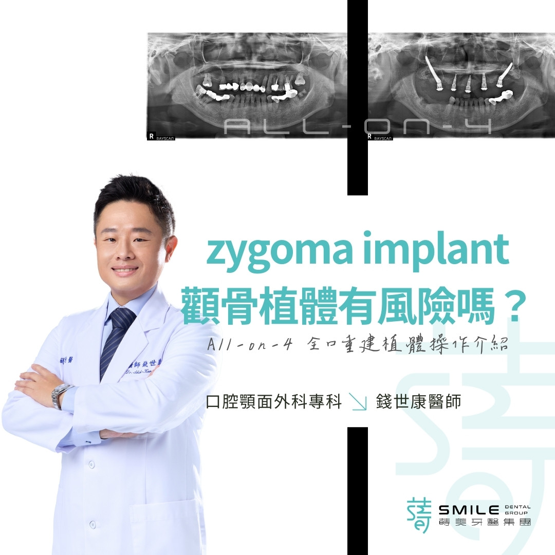 zygoma implant 顴骨植體有風險嗎？