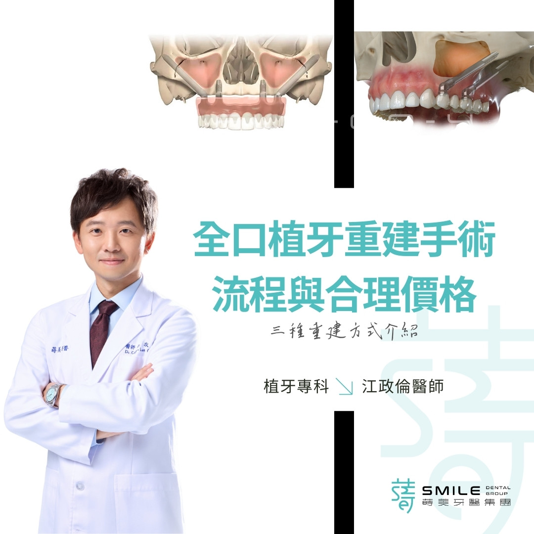 一篇了解全口植牙重建手術流程與合理價格