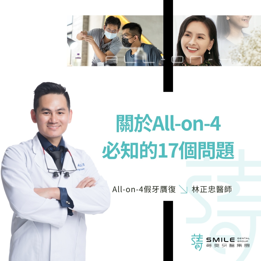 關於All-on-4 一定得知道的12個問題