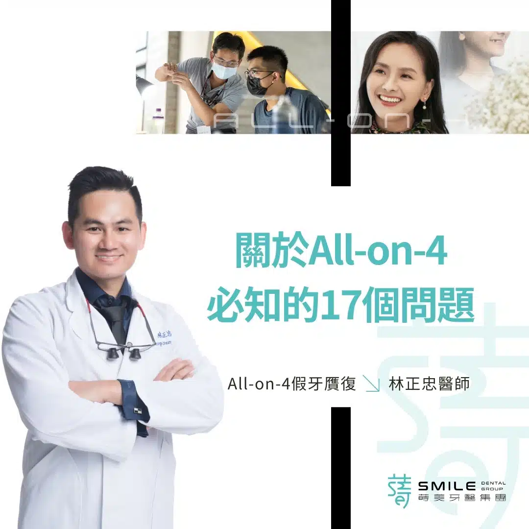 關於All-on-4 一定得知道的12個問題