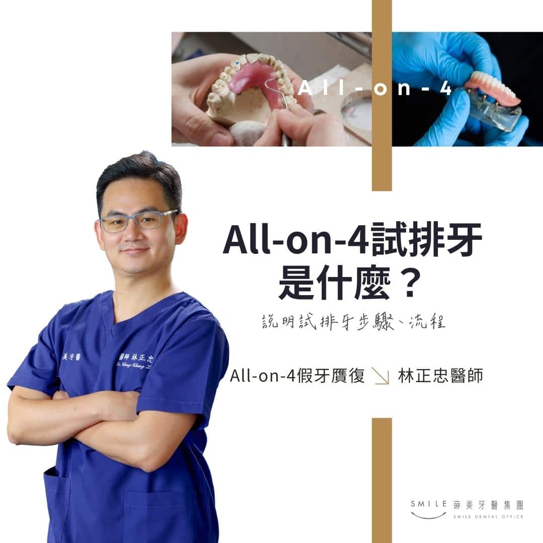 All-on-4試排牙