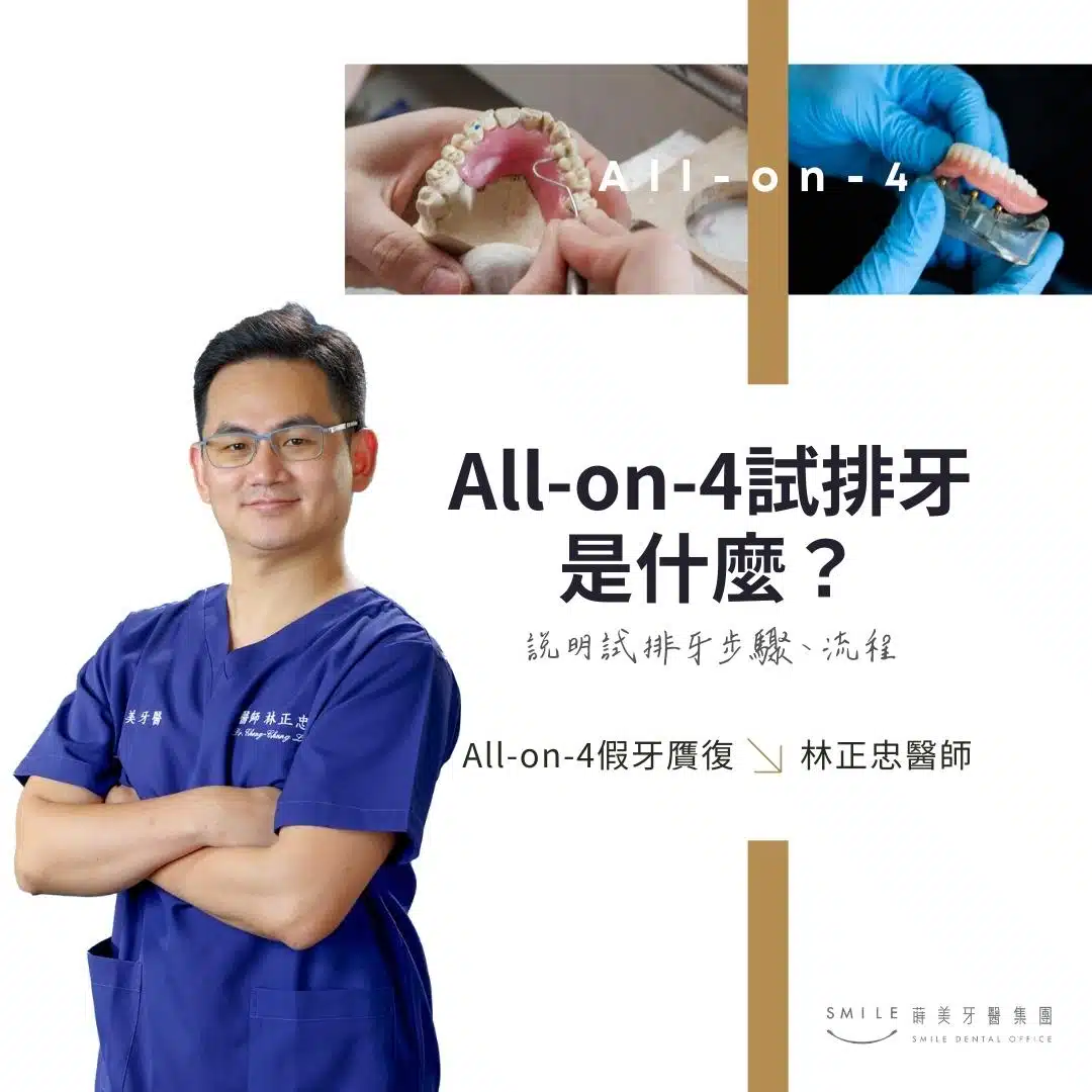 All-on-4試排牙