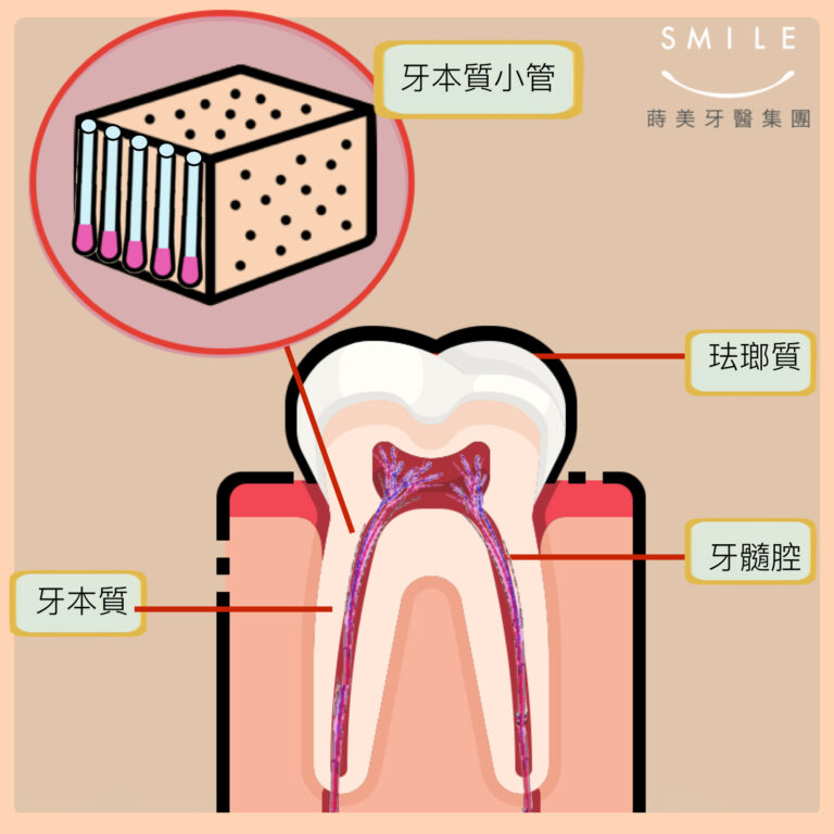 蒔美醫師專欄牙齒好酸軟六招要注意-牙本質敏感-768x768