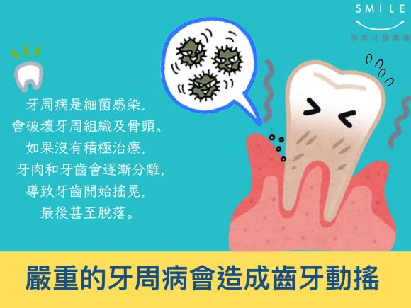 蒔美牙醫衛教老了未必會掉牙，成年人掉牙的主因其實是牙周病！3-580x435