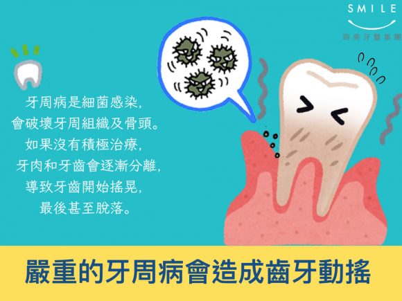 蒔美牙醫衛教老了未必會掉牙,成年人掉牙的主因其實是牙周病!3-580x435