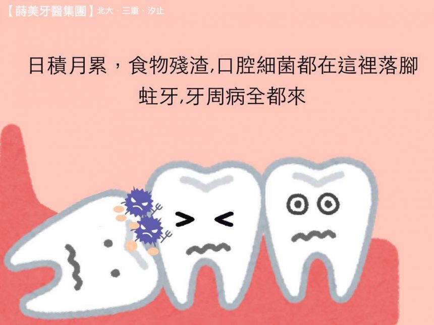 蒔美牙齒保健水平智齒該不該拔呢-2-860x645
