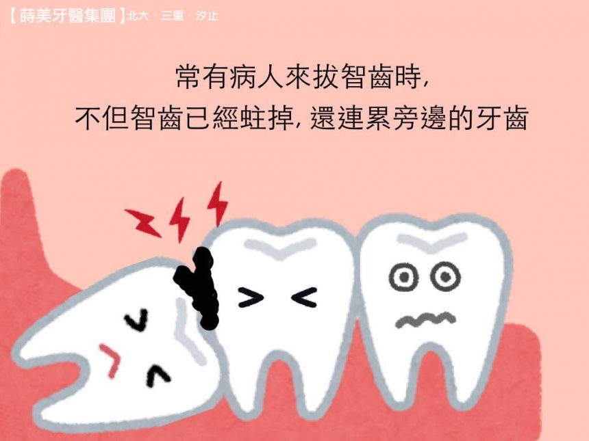 蒔美牙齒保健水平智齒該不該拔呢-3-860x645