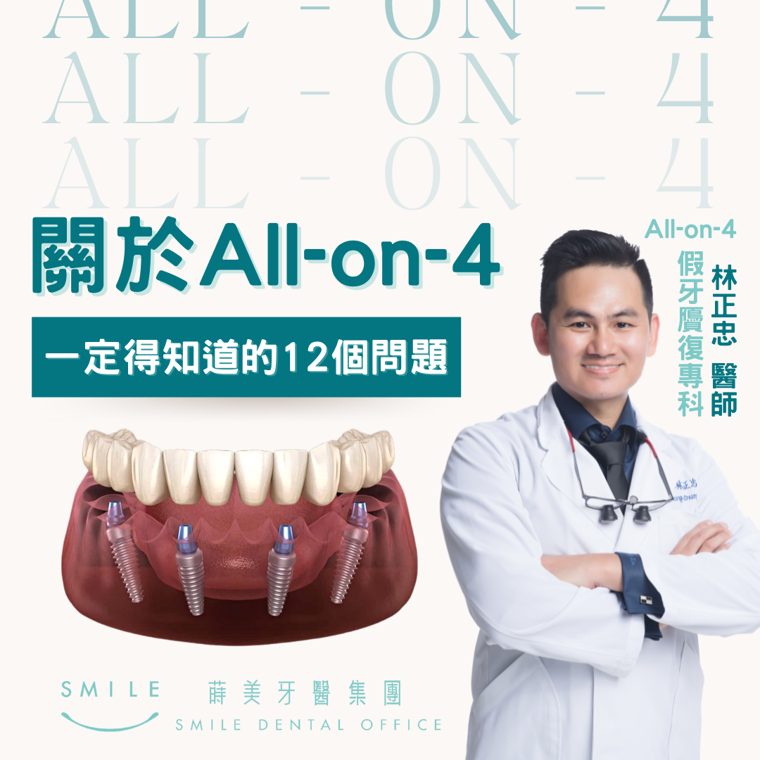 AO4 12個問題封面