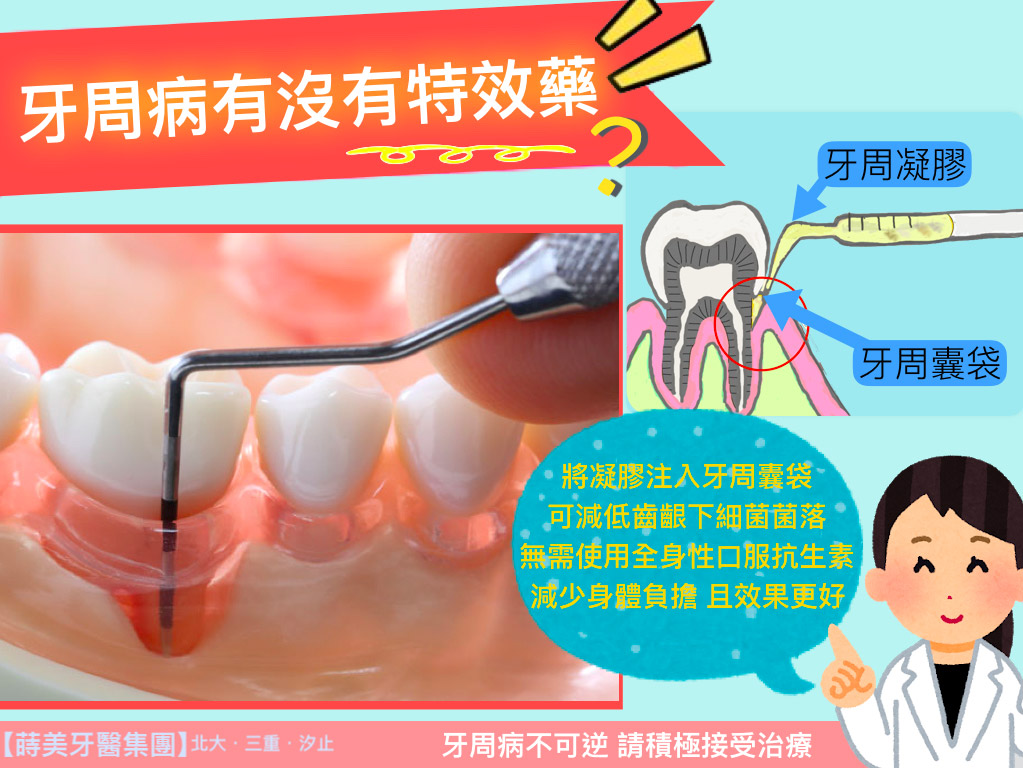 蒔美牙醫衛教牙周病有沒有特效藥？