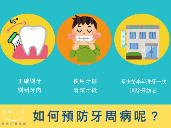 蒔美牙醫衛教老了未必會掉牙，成年人掉牙的主因其實是牙周病！4-580x435