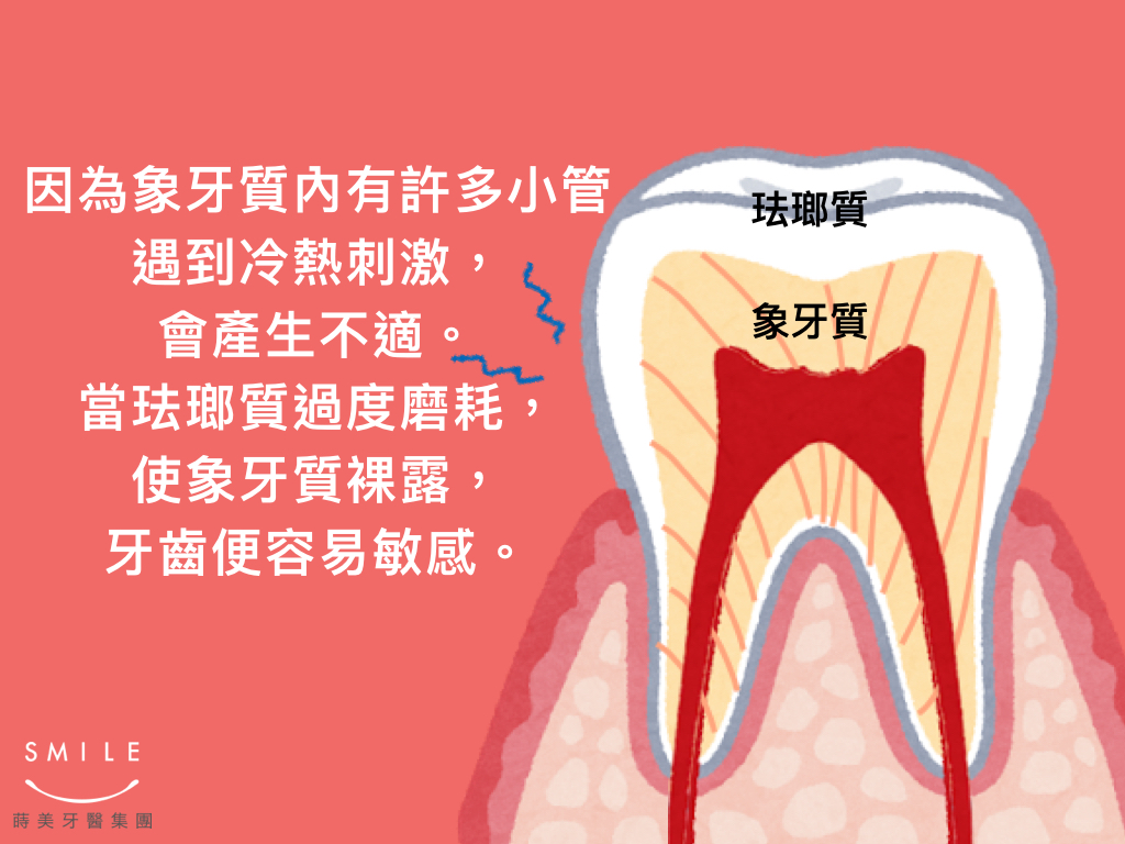 蒔美衛教文章如何對抗牙齒敏感.002