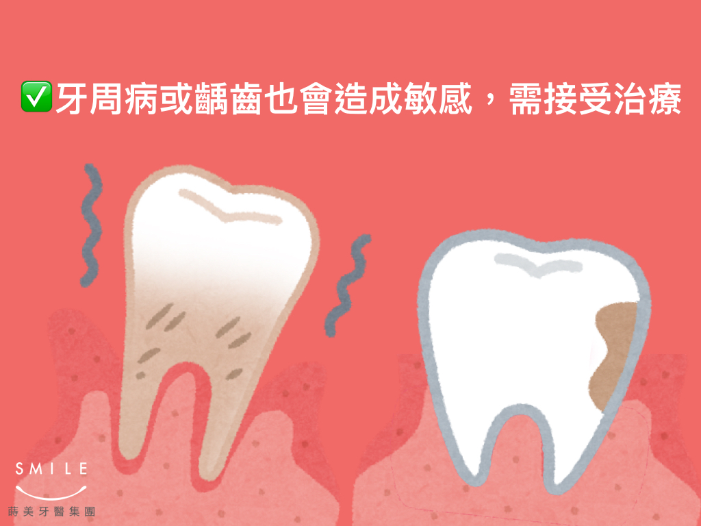 蒔美衛教文章如何對抗牙齒敏感.006