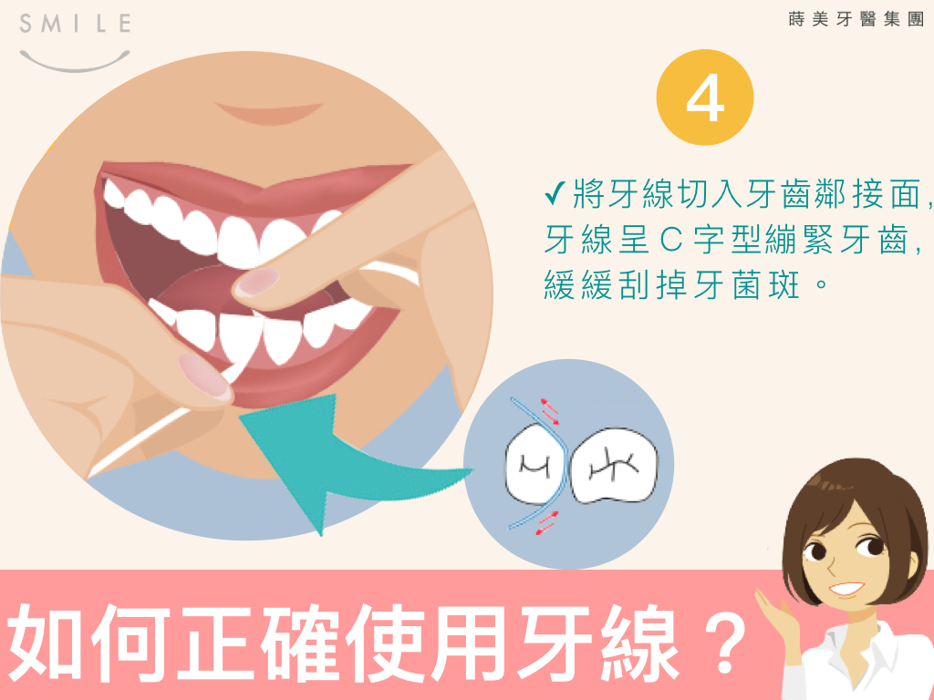 蒔美衛教文章用錯了等於沒用，五張圖看懂牙線正確用法.004