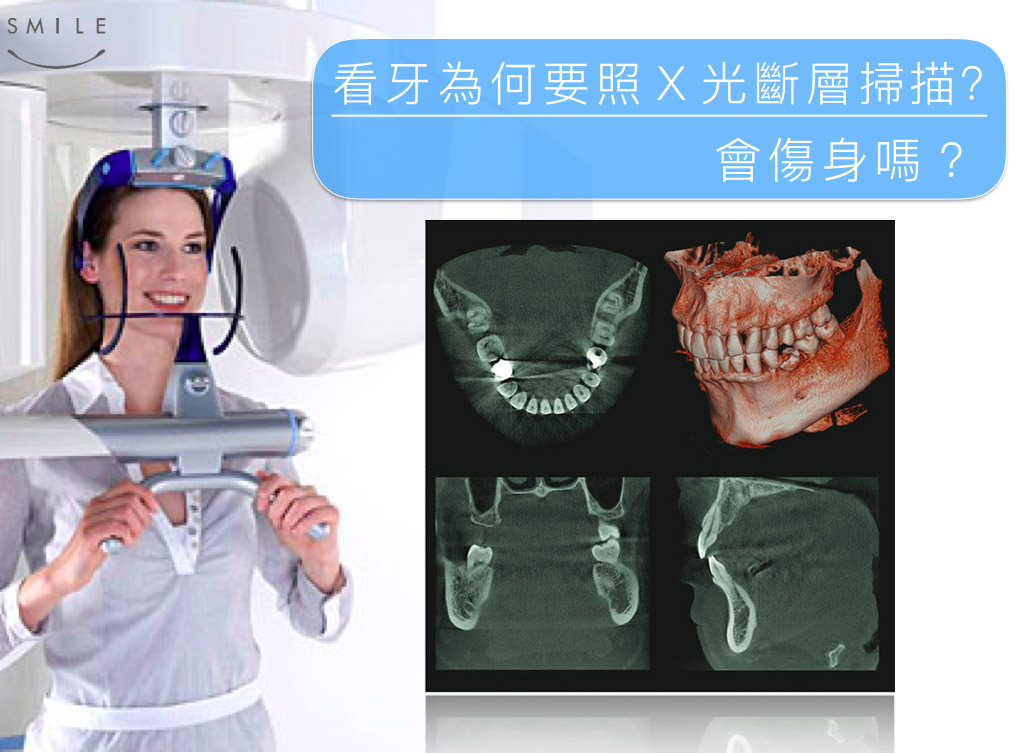 蒔美衛教文章看牙為何要照X光掃瞄會傷身嗎？