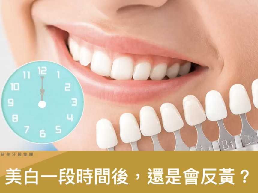 蒔美衛教文章美白一段時間後，還是會反黃？-860x645