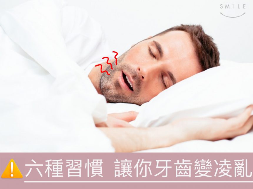 蒔美醫師專欄六䅜習慣讓你牙齒變凌亂-860x645
