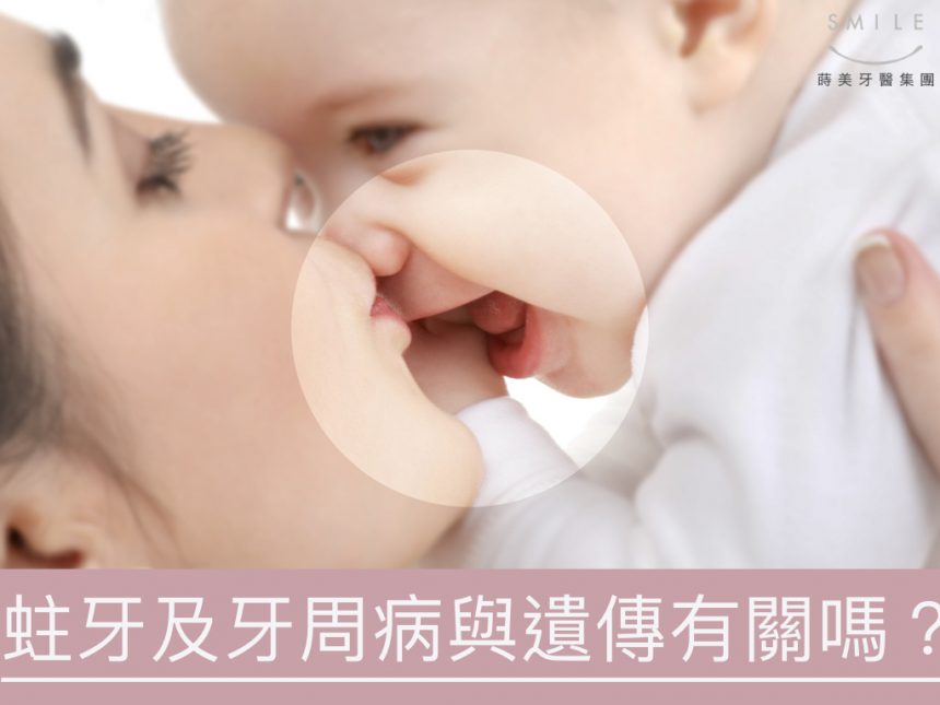 蒔美醫師專欄蛀牙與牙周病與遺傳有關嗎-860x645