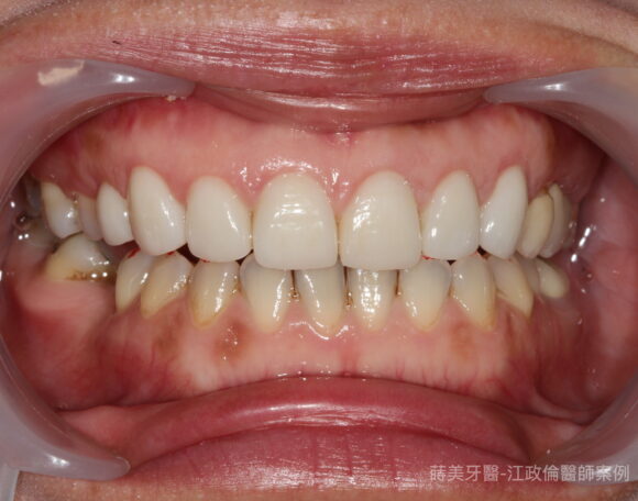 IMG_6537-580x456