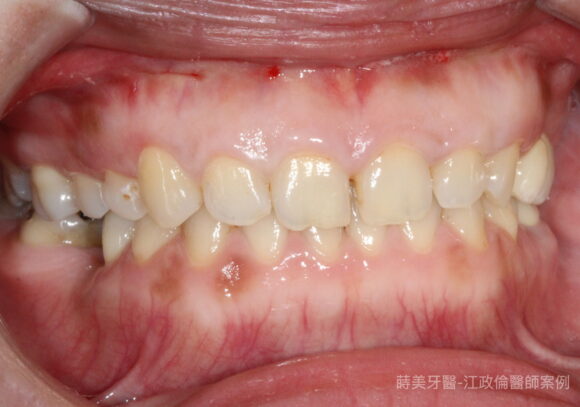 IMG_9940-580x407