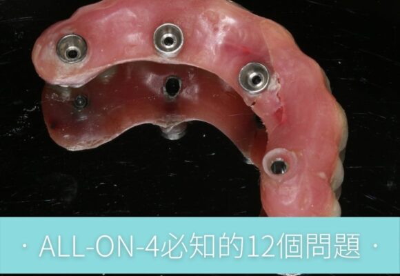 ao47-580x400