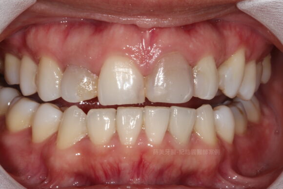 曾S1Before-580x387