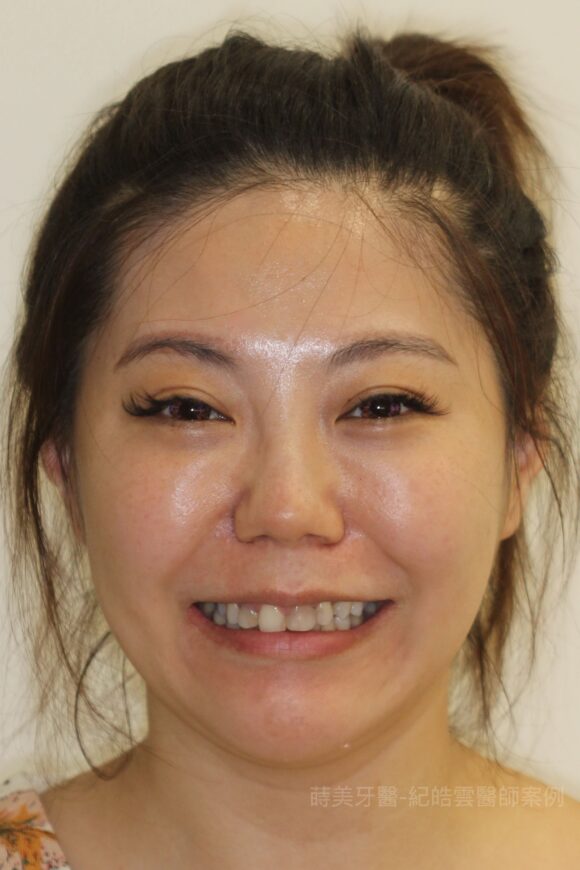 曾SFBefore-580x870