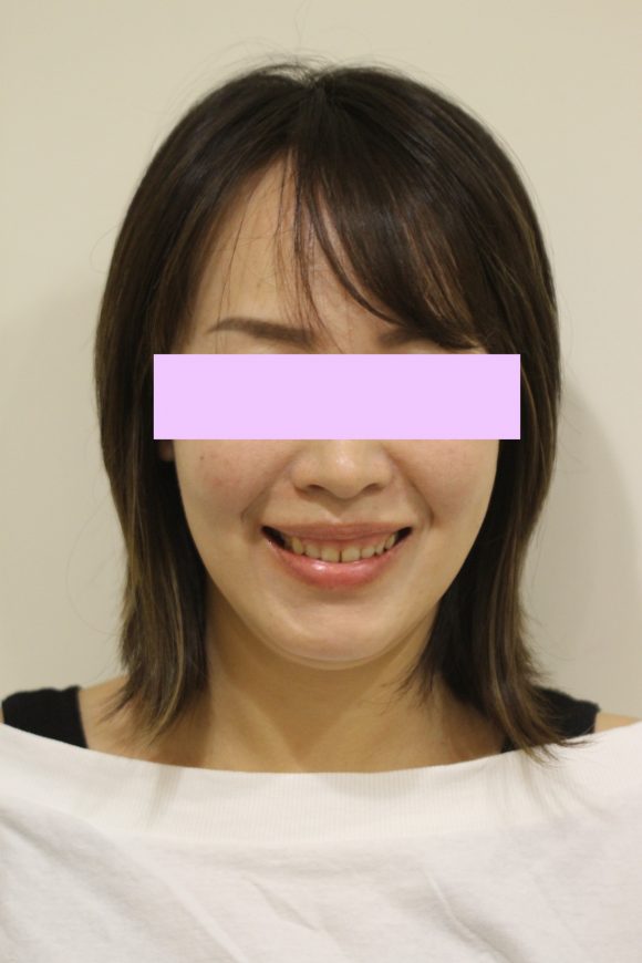 蒔美案例分享陶瓷貼片・美的見證01-580x870