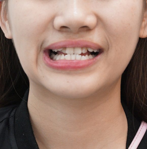 陳鈺婷醫師-Dr-Yu-Ting-Chen-article1-P12600x600-580x588