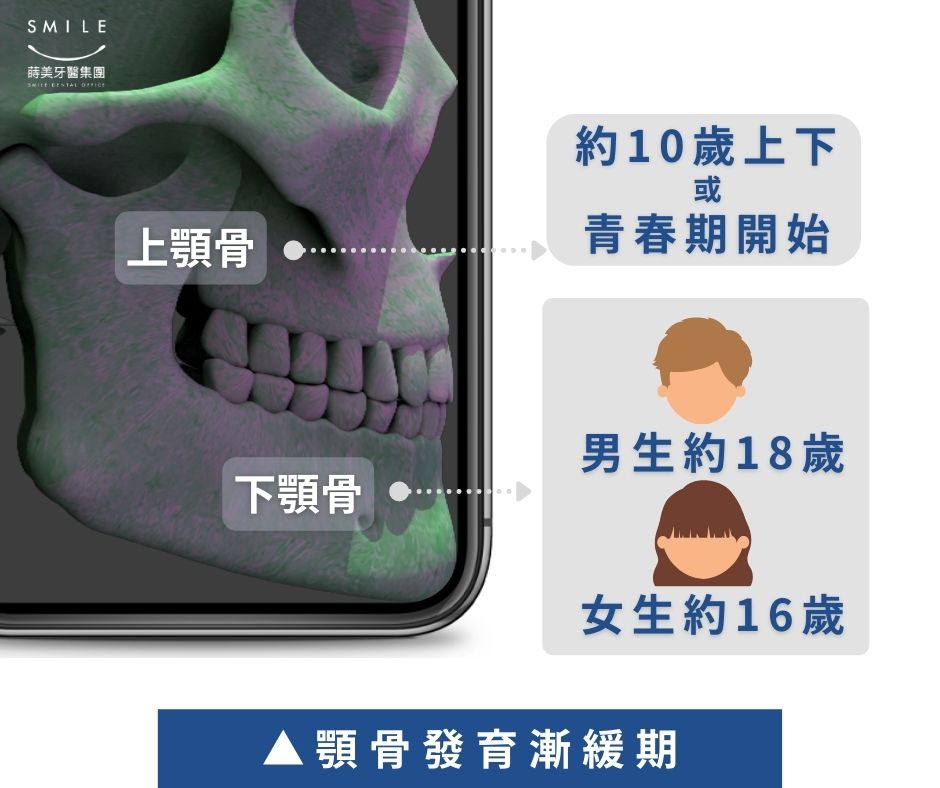 牙齒矯正要從小開始嗎？談談早期矯正 的複本 (10)