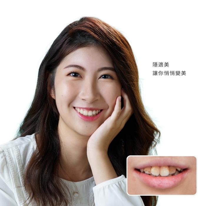 隱適美，讓你悄悄變美