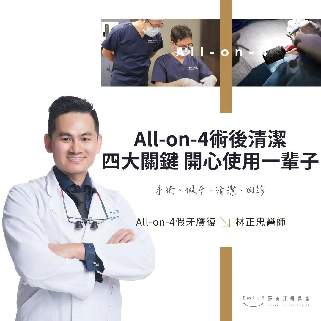 All-on-4術後清潔 四大關鍵