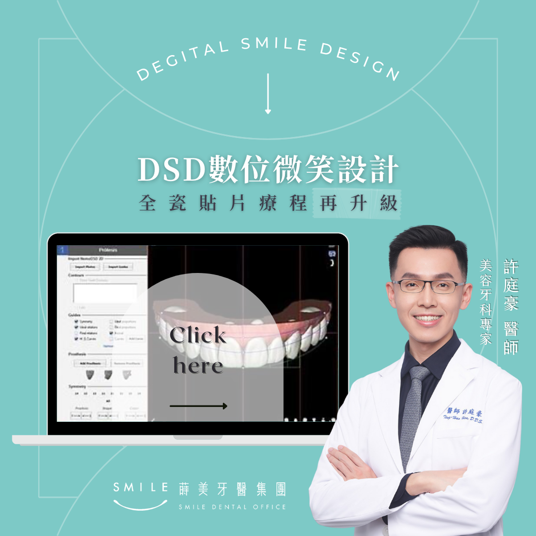 20210806_DSD數位微笑設計