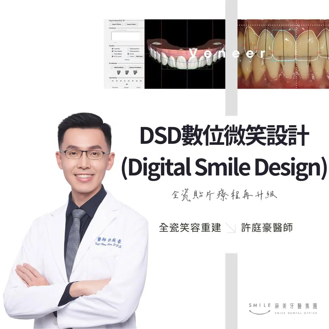 DSD數位微笑設計