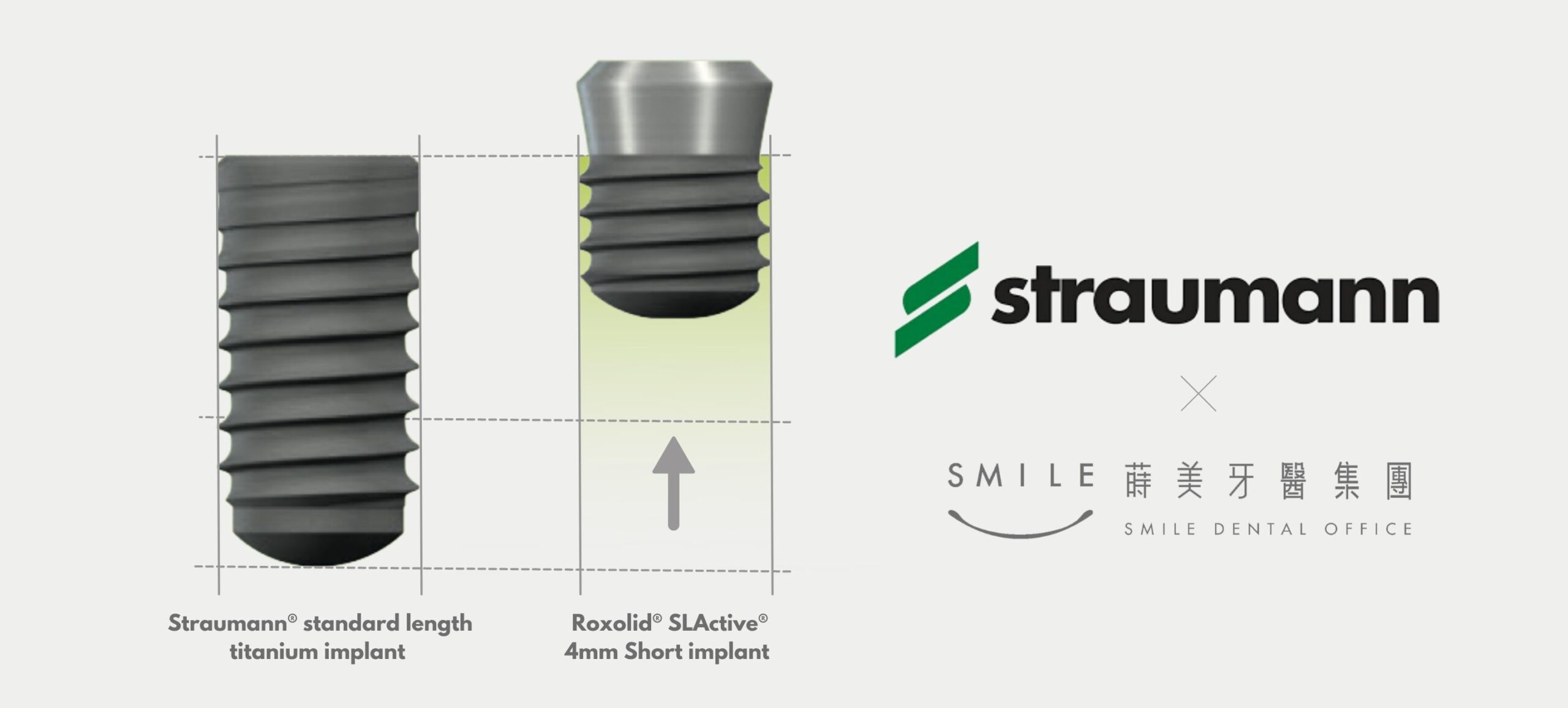 植牙品牌比較：Straumann與諾保科差異？ (3)