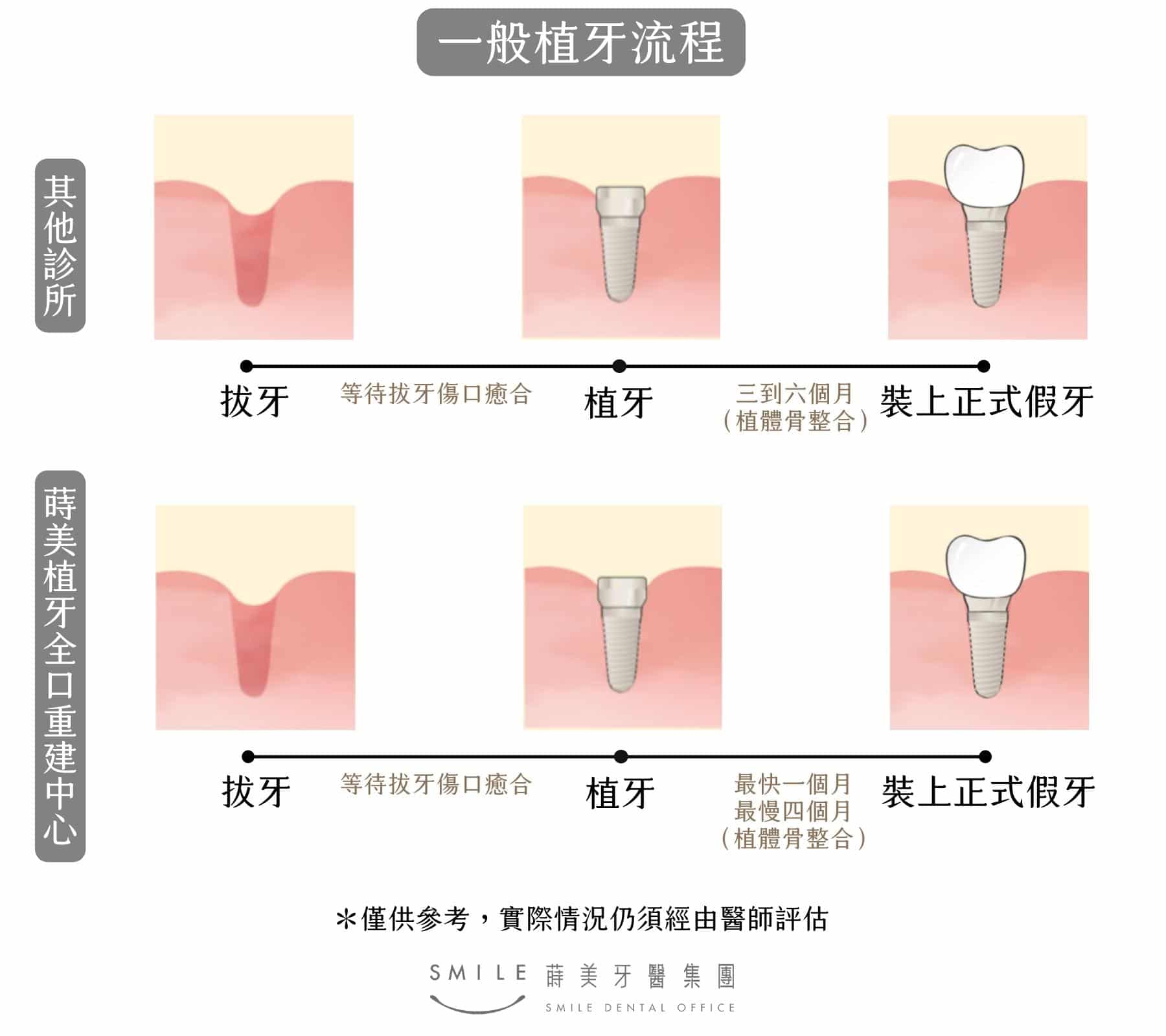 一般植牙花費時間及流程｜台北新北蒔美牙醫集團｜All-on-4全口重建/植牙專科醫師團隊