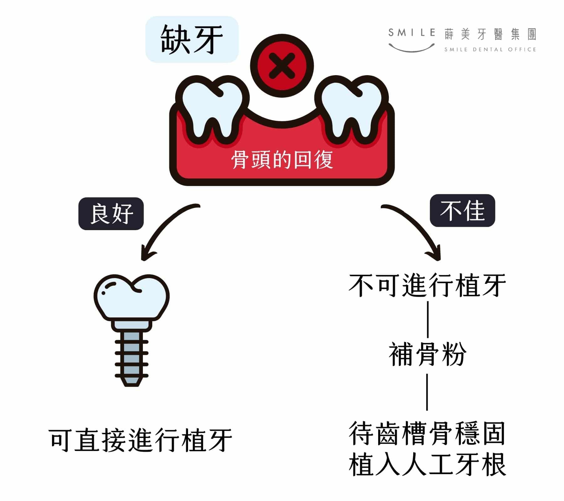 使用補骨粉打造適合植牙的環境