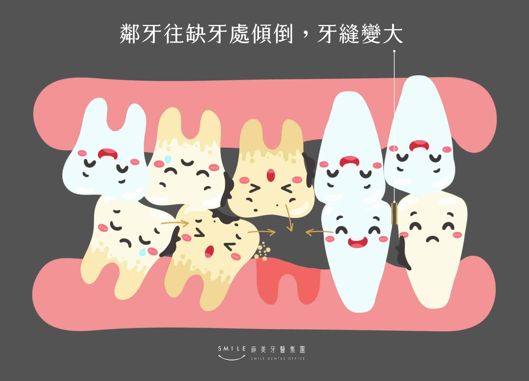 牙縫大原因：長期缺牙