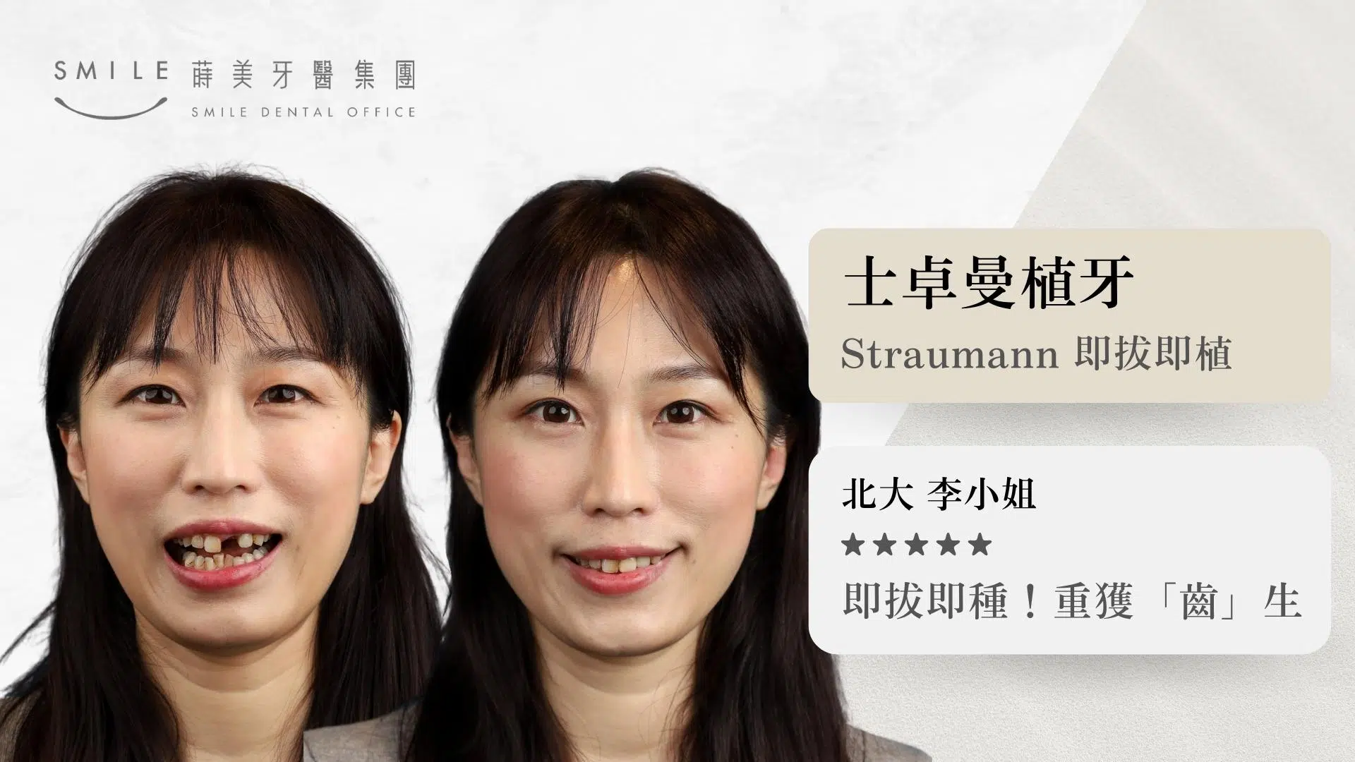 蒔美straumann即拔即植案例