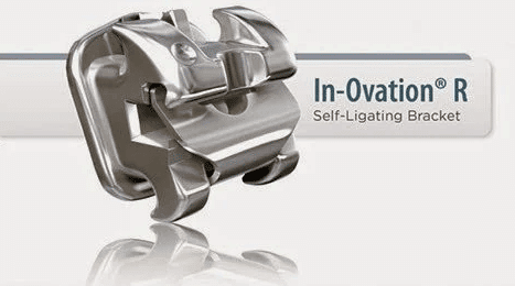 自鎖矯正器為牙材大廠Dentsply的In-Ovation系列。
