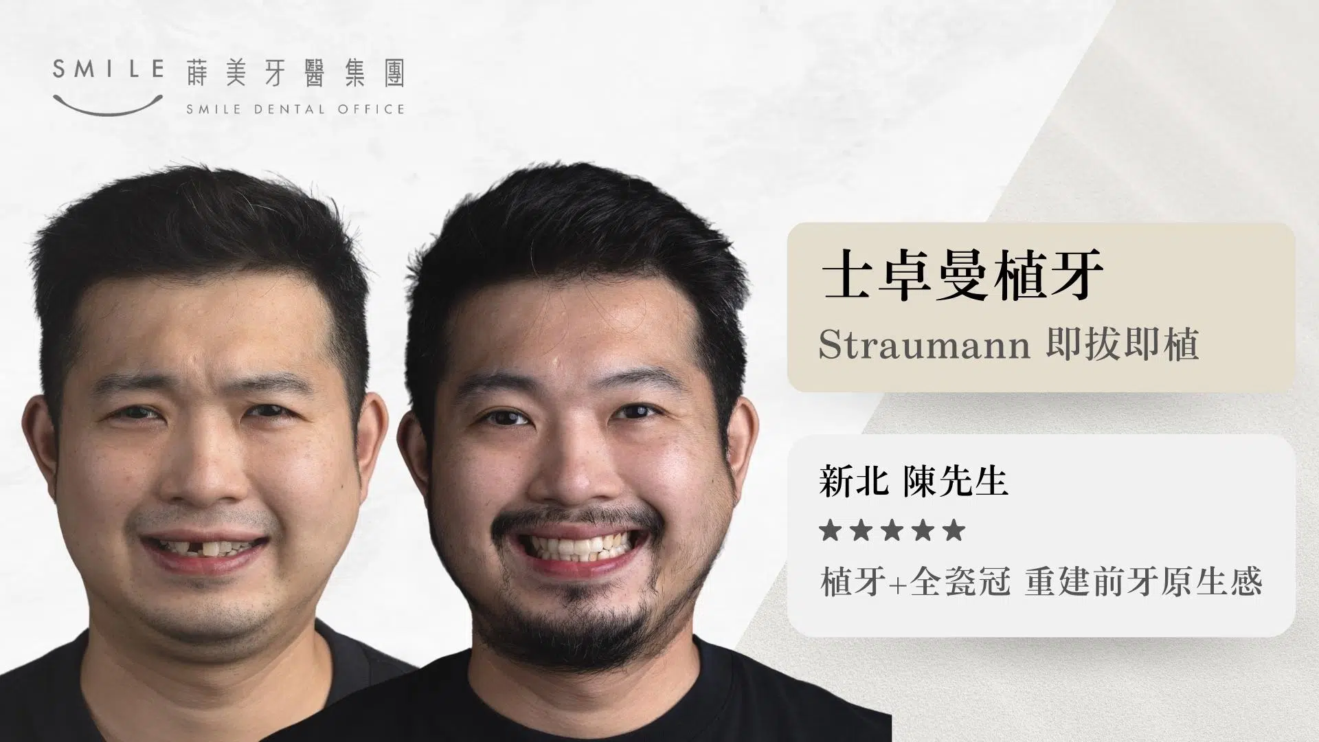 蒔美straumann即拔即植案例｜台北新北蒔美牙醫集團｜All-on-4全口重建/植牙專科醫師團隊