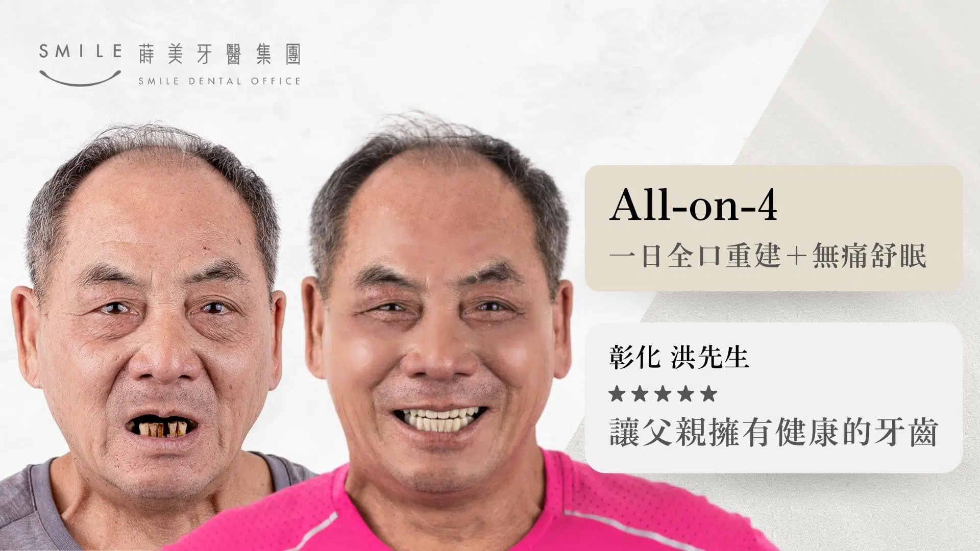 蒔美全口重建All-on-4案例｜台北新北蒔美牙醫集團｜All-on-4全口重建/植牙專科醫師團隊