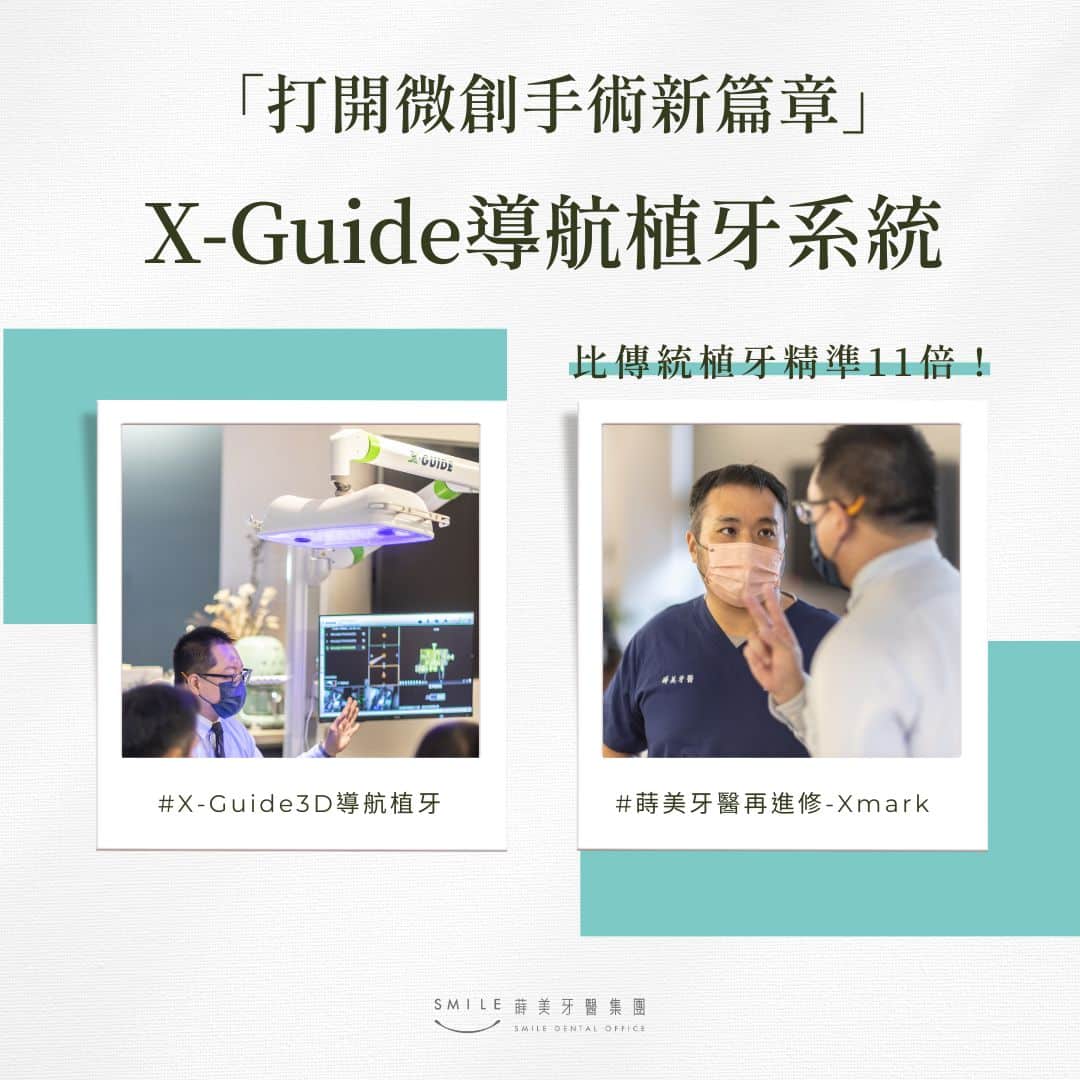 打開為創手術新篇章X-Guide導航植牙系統