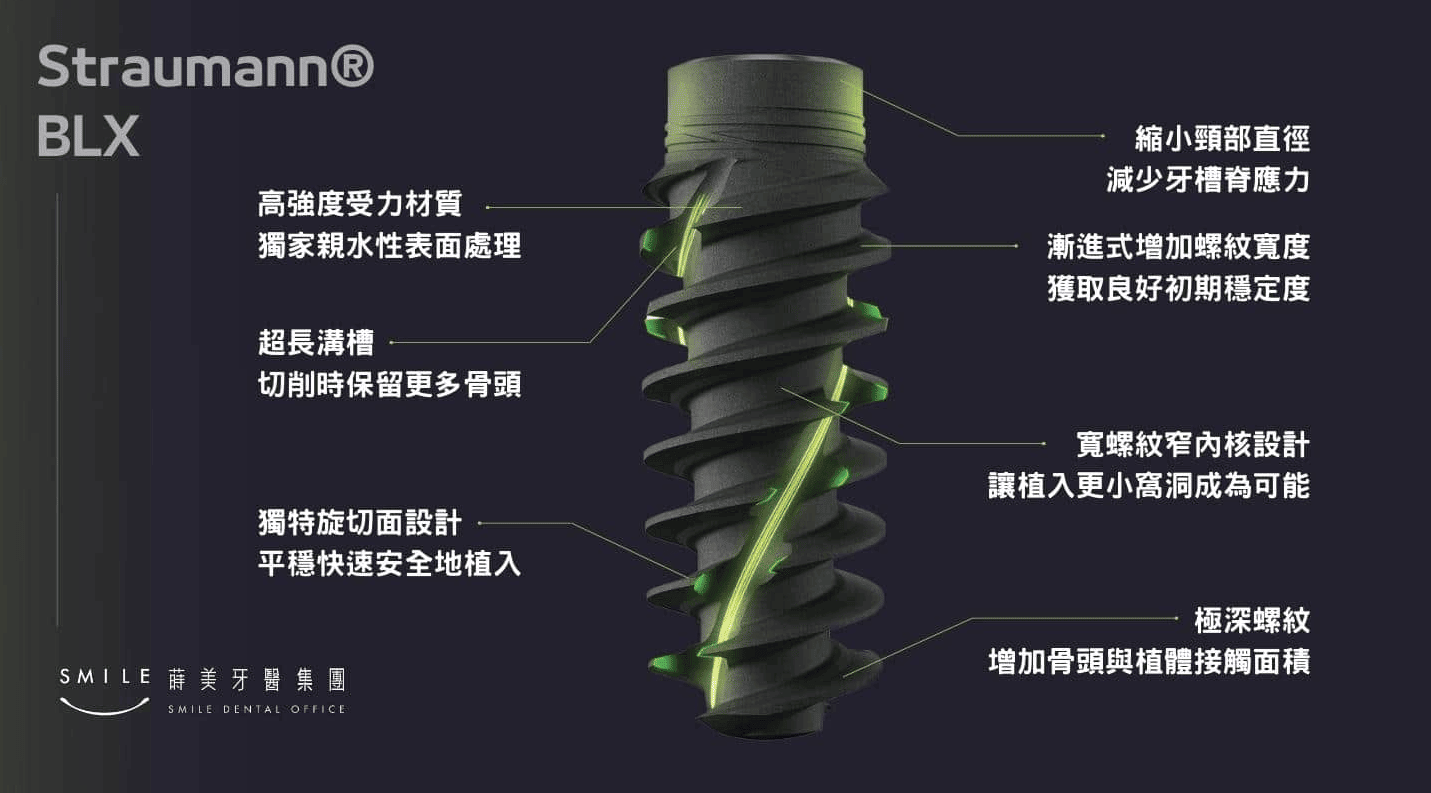 Straumann implant