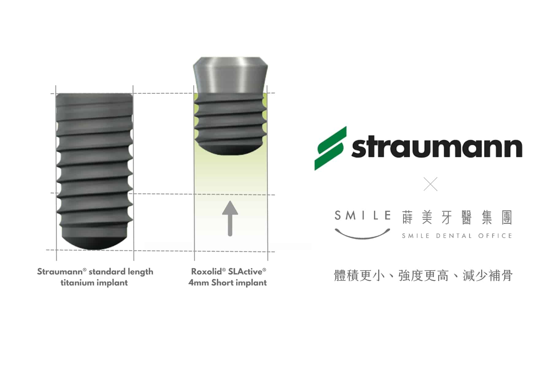 Straumann植體體積更小、強度更高、減少補骨