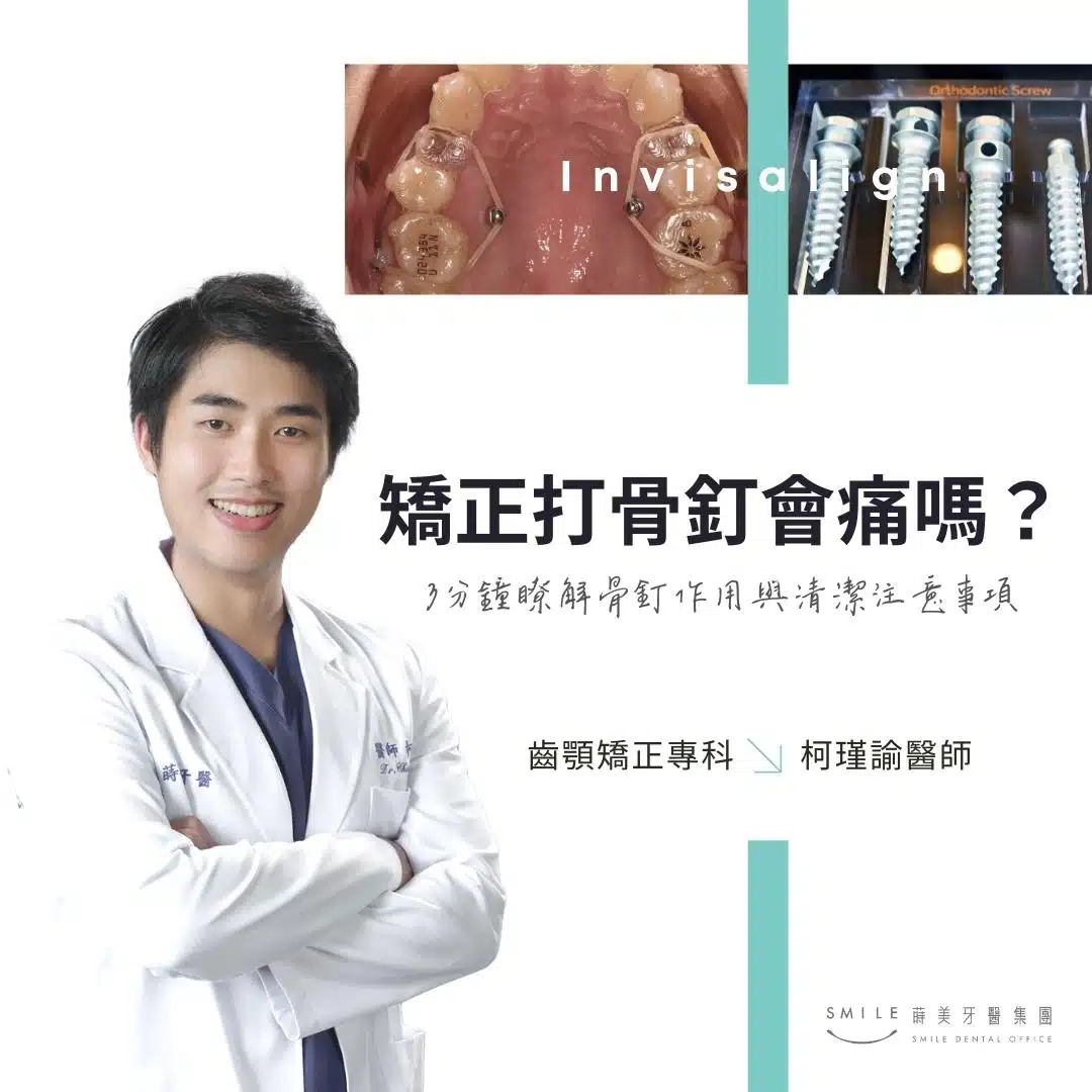 牙齒矯正打骨釘會痛嗎？