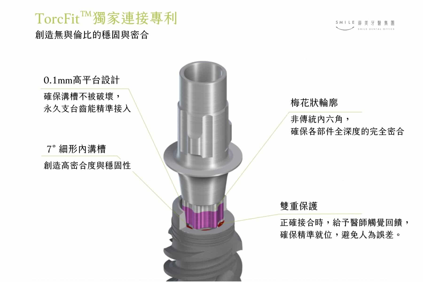 Straumann implant